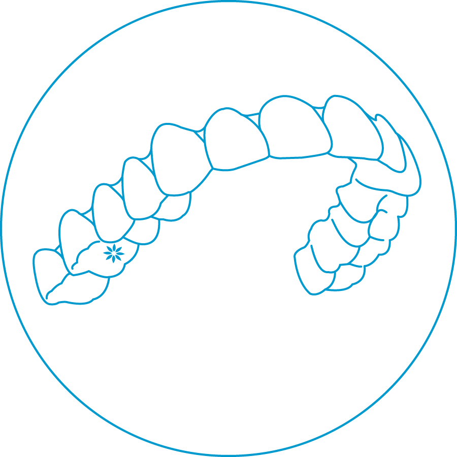 2. THE CLEAR ALIGNERS