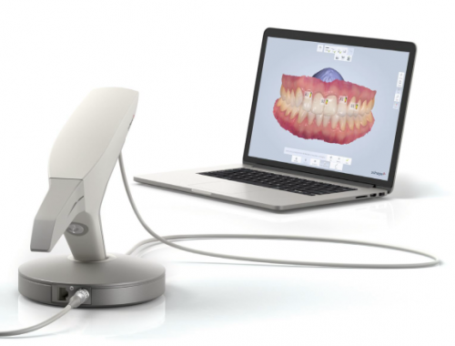 appareil d'empreinte dentaire intraoral 3D pour traitement dentaire et invisalign